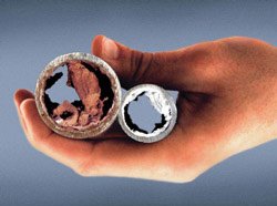 Dépôts calcaire dans les conduites